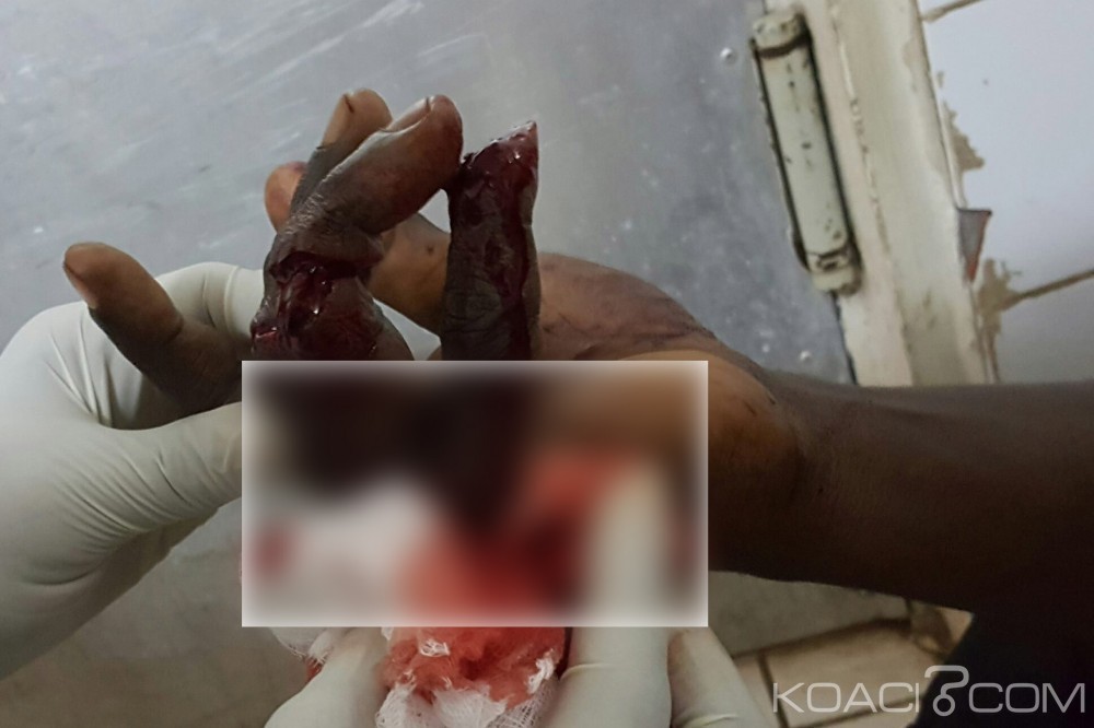 Côte d'ivoire: Les microbes attaquent plusieurs domiciles à  Abobo, un blessé grave