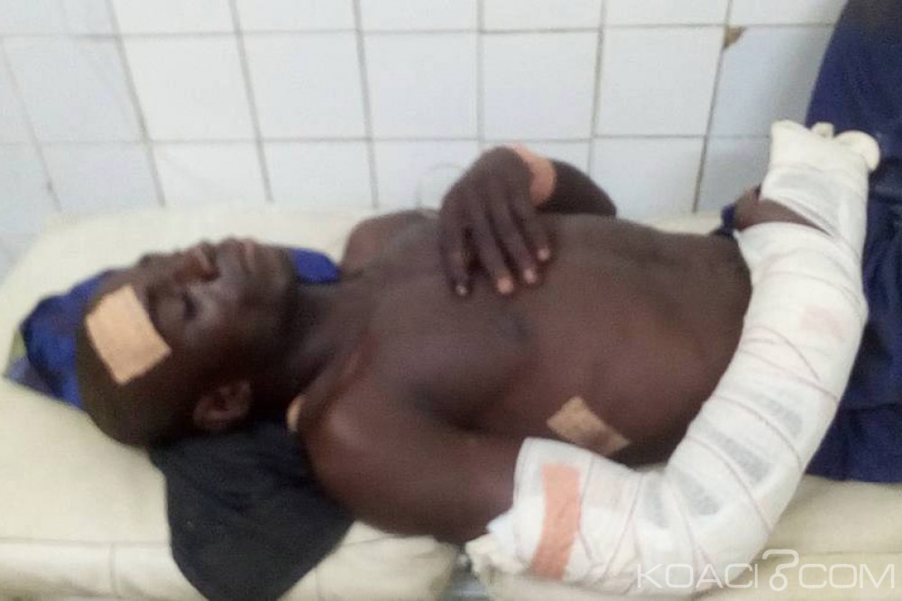 Côte d'Ivoire: Kouto, un individu tailladé à  la machette dans un état piteux, la population sur pied de guerre