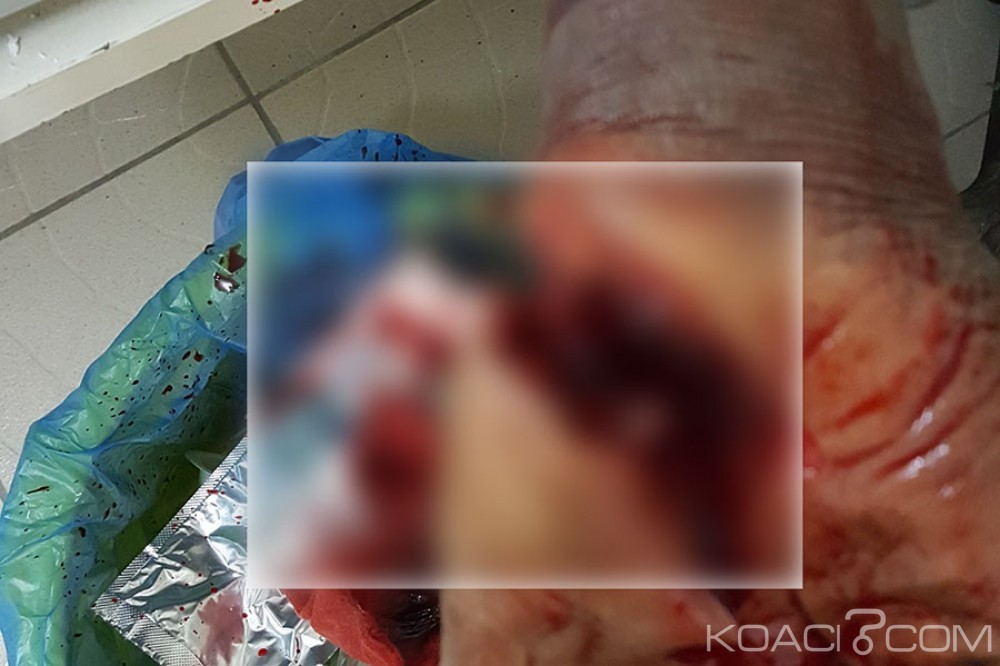 Côte d'Ivoire: Treichville, sous drogue un jeune libanais se coupe les veines et meurt