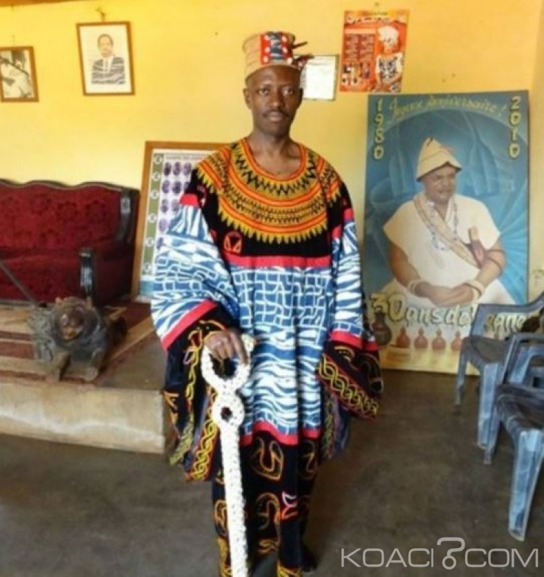 Cameroun: Dr Clément Petsoko, le chef traditionnel qui  lutte contre l'obésité et le surpoids au Cameroun