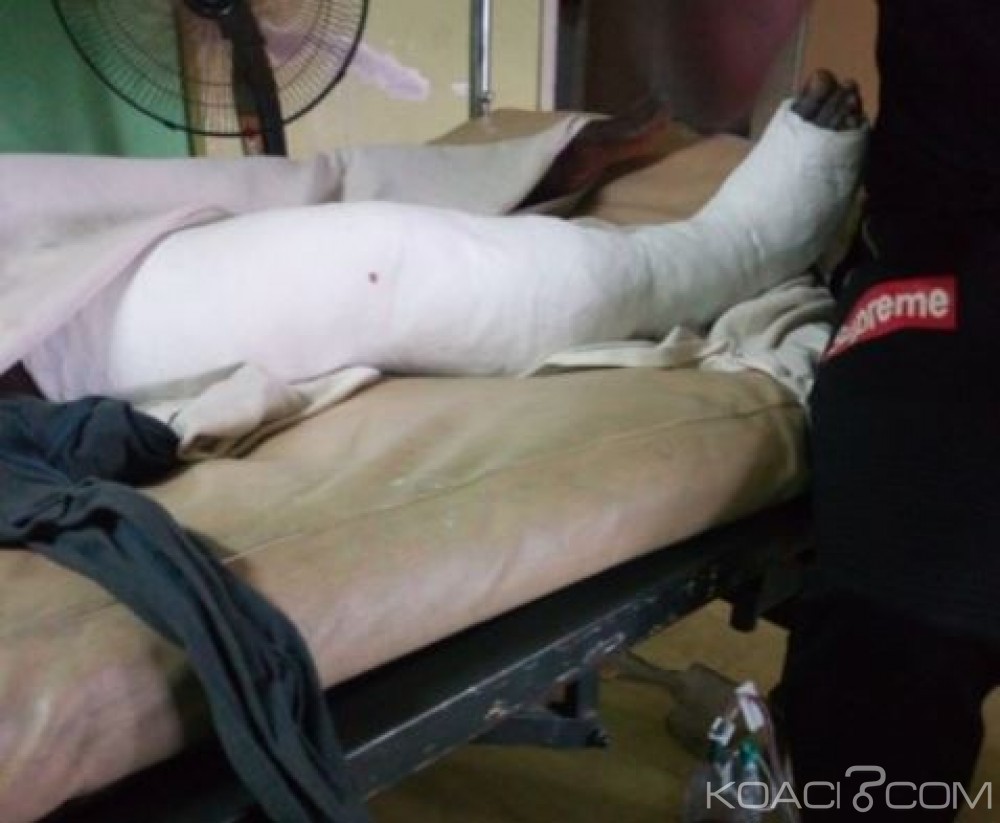 Côte d'Ivoire: Récentes attaques à  Abidjan, une victime par balles raconte son calvaire et dévoile l'identité du commando