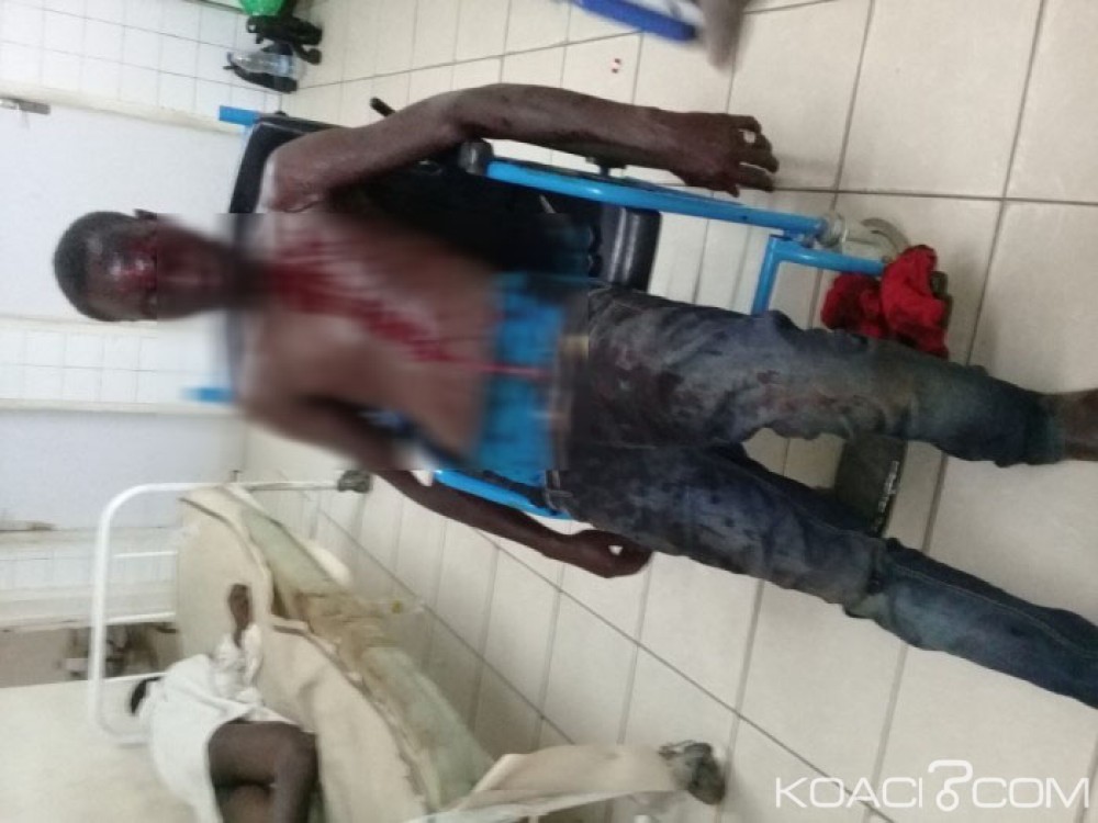 Côte d'Ivoire: Les microbes lui arrachent un œil et tuent  un autre homme