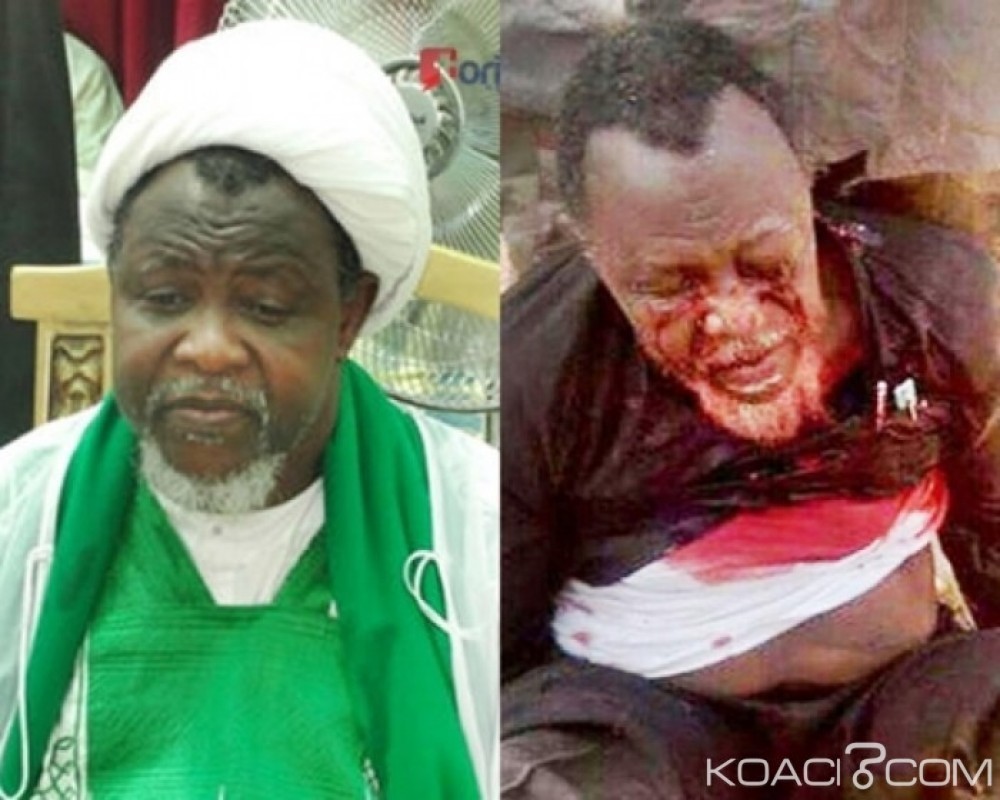 Nigeria: La vie du chef chiite  Ibrahim Zakzaky en danger, selon son avocat