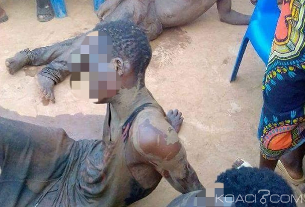 Côte d'Ivoire: Reconnu par les habitants, un bandit lynché à  Abobo