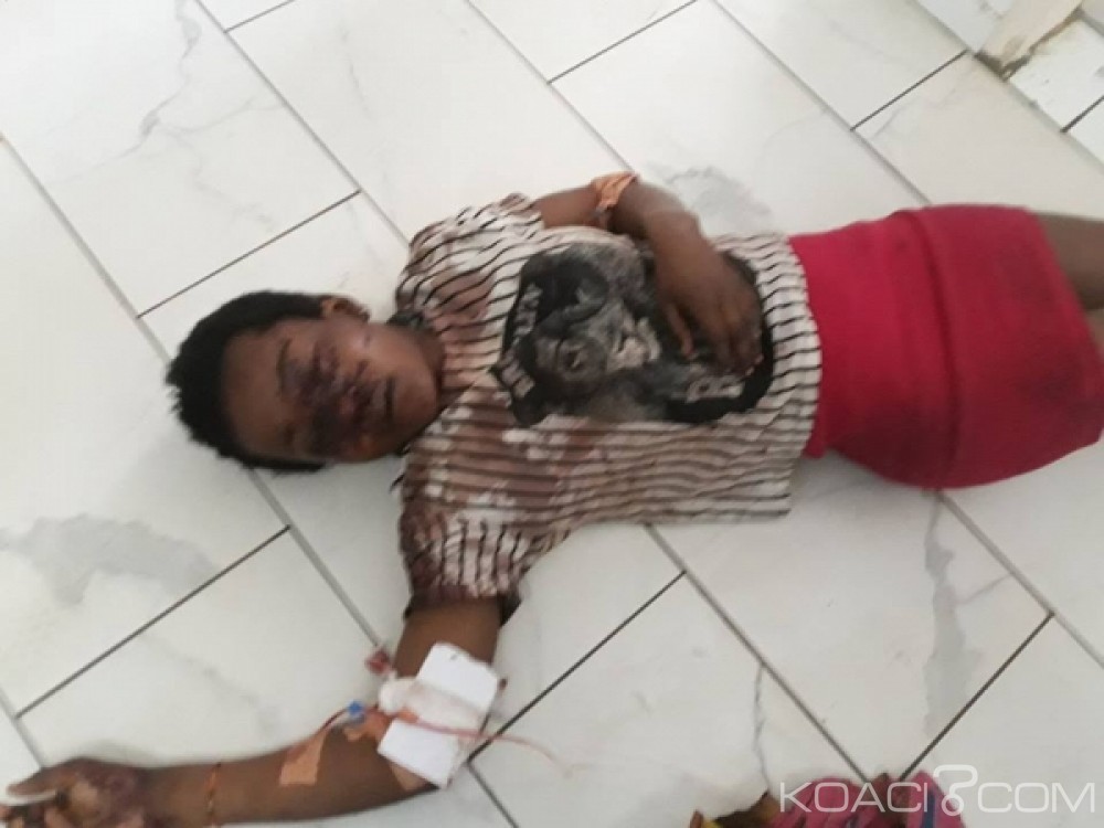 Côte d'Ivoire: Une victime d'accident de la circulation prise en charge en attente de ses parents au CHU de Yop
