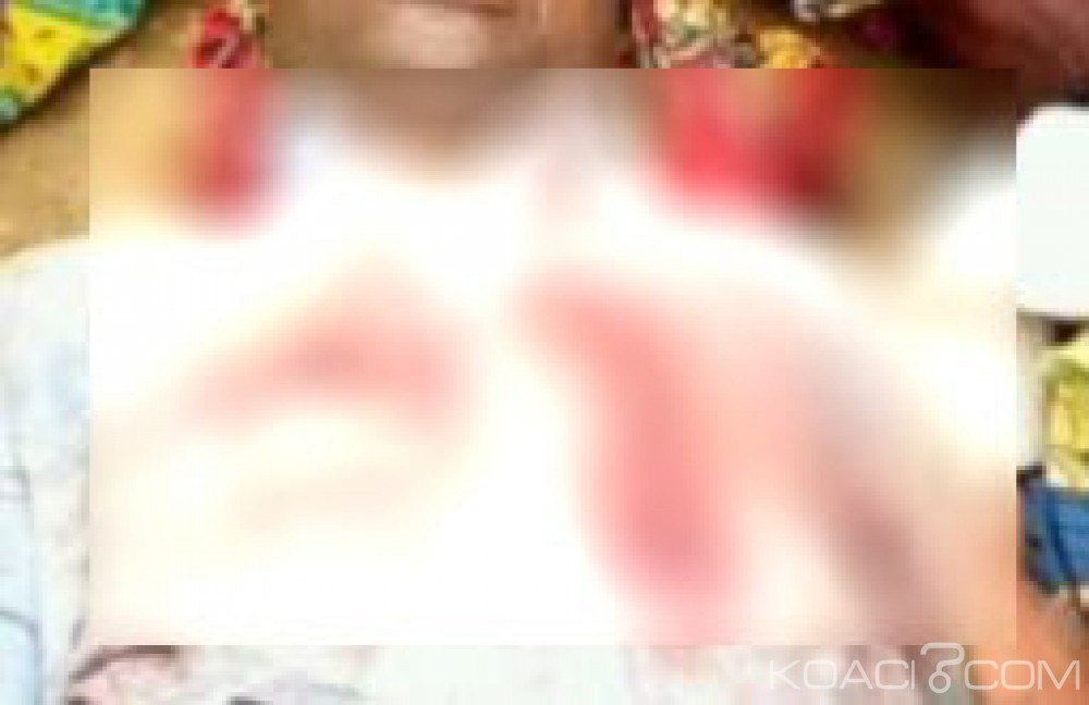 Côte d'Ivoire: Un homme défèque dans un hôtel et se tue