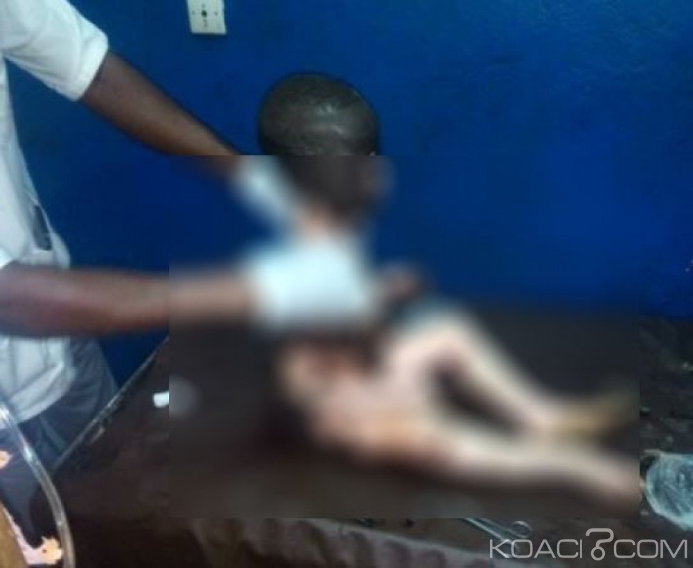 Côte d'Ivoire: Abengourou, une bouteille de gaz explose dans un domicile, des blessés par brûlure enregistrés