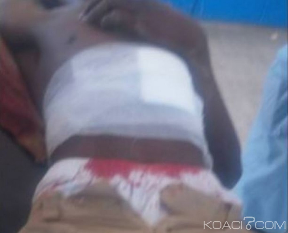 Côte d'Ivoire: Un élève poignardé à  Korhogo, plus de peur que de mal