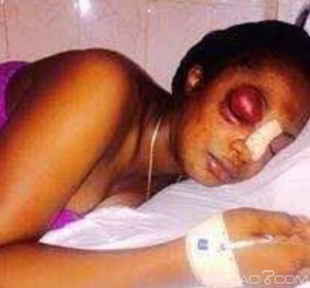 RDC: Une jeune femme meurt après avoir été tabassée par son mari à  Kinshasa