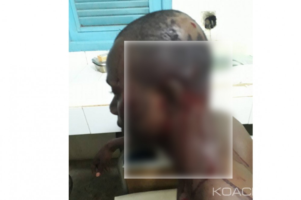 Côte d'Ivoire: Kouassi-Kouassikro, le centre de santé urbain attaqué à  la kalachnikov, un blessé