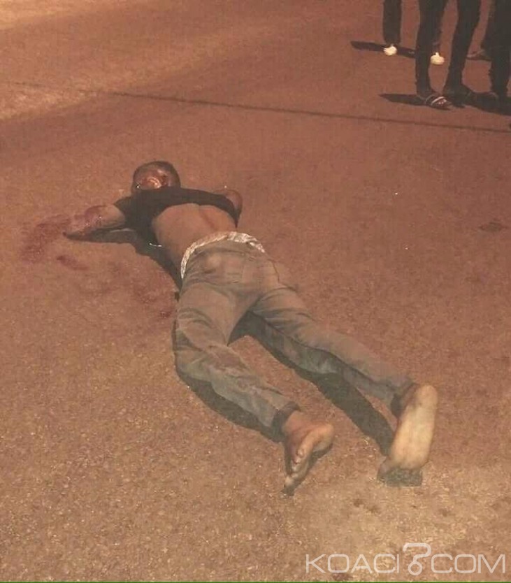 Côte d'Ivoire : Un étudiant percuté violemment par un véhicule de luxe, frôle la mort