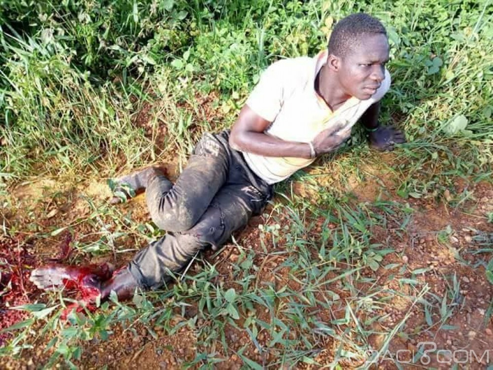 Côte d'Ivoire: Aboisso, le pied d'un motocycliste arraché après un choc