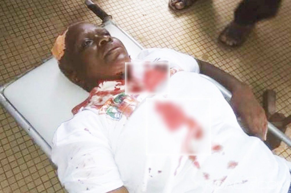 Côte d'Ivoire : Municipales 2018, violences à  Guiglo entre des partisans de deux candidats, des blessés et des dégà¢ts matériels