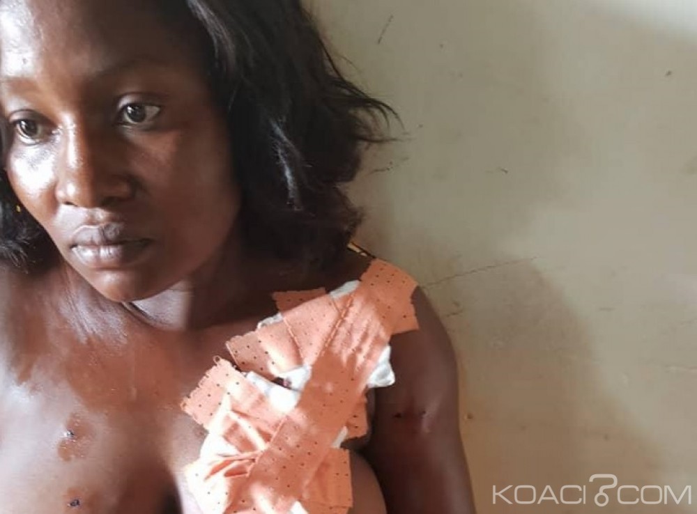 Côte d'Ivoire : Locales 2018,  une assesseure d'un bureau de vote blessée par balle à  Agnibilékrou