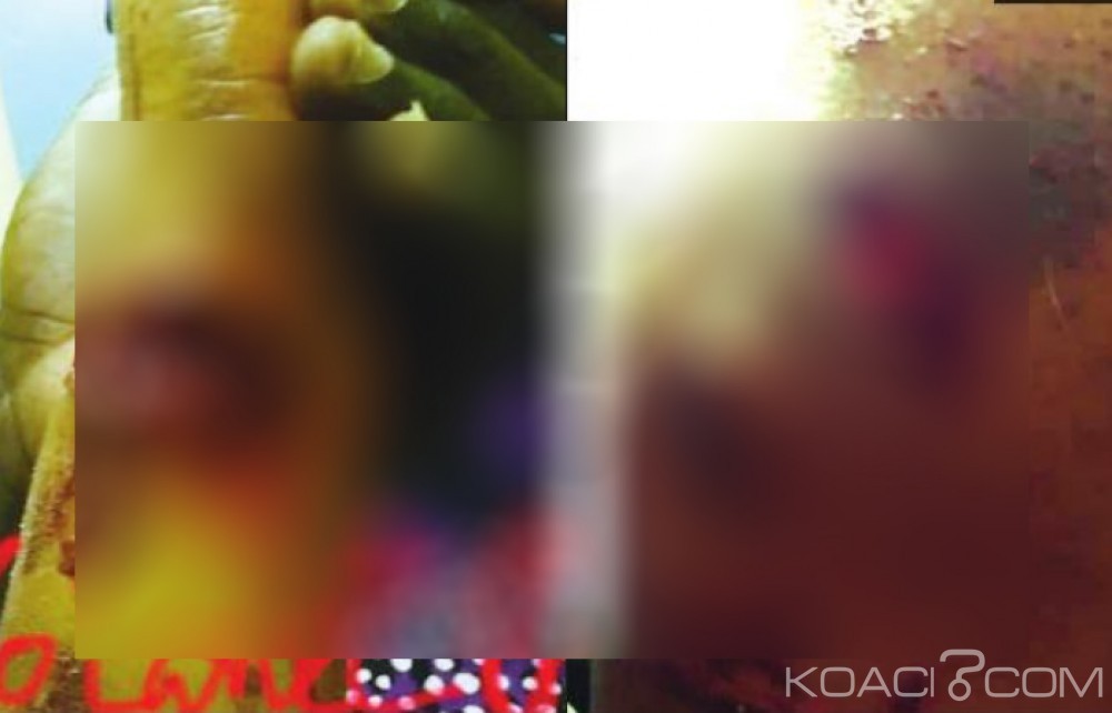 Sénégal : Jalouse, elle assène 4 coups de machette à  sa coépouse la veille de sa nuit de noce