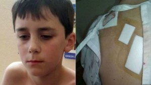 Afrique du Sud : Un  écolier de 10 ans mordu par un guépard