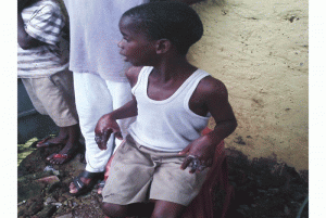 Guinée : Elle repasse le dos de son garçon de 6 ans avec un fer à  repassé et brule ses deux mains pour 500 Francs guinéen