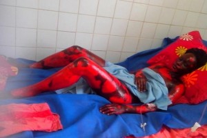 Gabon: Des dégà¢ts corporels et matériels importants après une mystérieuse détonation