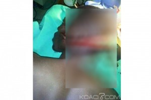 Sénégal: Les conducteurs de moto taxi en danger dans la zone de Kaolack, plus d'une dizaine d'agressions en moins d'un mois