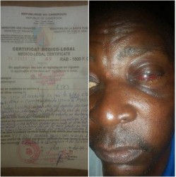 Cameroun: Bertoua, un adjoint du sous-préfet tabasse copieusement un commerçant