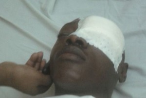 Gabon: Un homme crève un oeil à  un autre à  l'aide d'une bouteille à  Mandji