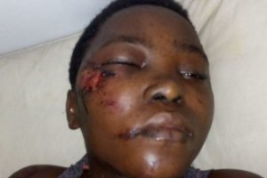 Côte d'Ivoire: Une jeune fille mal en point à  la recherche  de ses parents