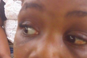 Côte d'Ivoire: Abandonnée par son père et maltraitée par sa belle mère