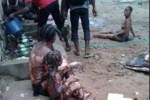 Côte d'Ivoire: Un malade se jette du 11ème étage du Chu de Cocody