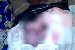 Cameroun: Hôpital central, des quadruplés trouvent la mort dans des circonstances troubles