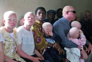 Malawi: Dix arrestations après le meurtre d'une femme albinos  de 21 ans
