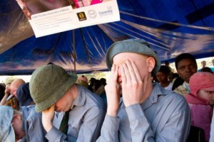 Malawi: Amnesty dénonce une vague d'attaques contre les albinos, victimes de crimes rituels