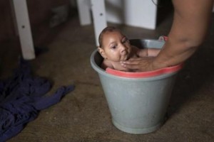 Cap Vert :11 bébés dont un mort né  atteints du virus Zika