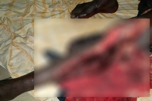 Côte d'Ivoire: Soupçonnés de vol et agression, deux individus lynchés à  mort  à  Yopougon