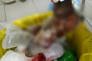 Côte d'Ivoire:  Nu et ligoté à  un arbre, un homme battu à  mort à  Abobo