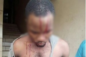 Cameroun: Grève des étudiants à  l'Université de Buea, les violences policières soulèvent l'indignation
