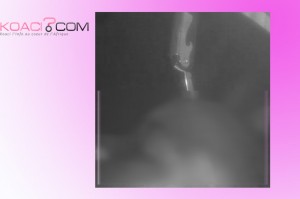 Côte d'Ivoire: Voulant fuir un pétard, un petit garçon se plante un couteau dans la tête