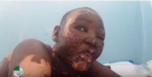 Cameroun: Horreur à  Douala, un couple repasse le corps de leur fille de 31 ans