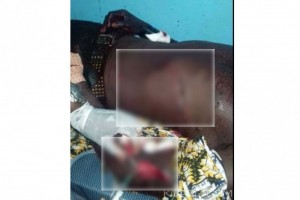 Côte d'Ivoire: Insécurité, un artiste reçoit plusieurs coups de couteaux à  Koumassi