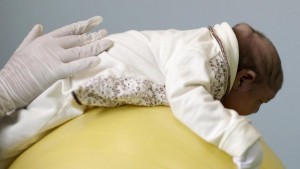Angola:  Virus Zika, une femme et son bébé contaminés