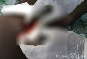 Côte d'Ivoire:Deux hommes meurent de la tuberculose en pleine rue