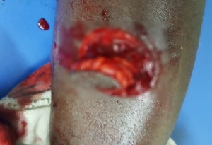 Côte d'Ivoire: Adjamé, décès d'un homme poignardé en pleine rue