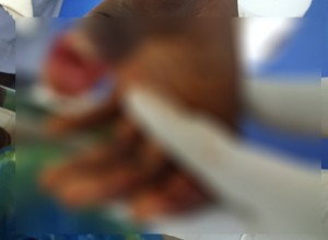 Côte d'Ivoire: Attécoubé, il est surpris entrain d'égorger un jeune homme