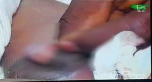 Cameroun: Mystère, un bébé nait avec un sexe déjà  circoncis à  Bafia