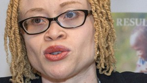 Malawi:  Une experte indépendante del'ONU  plaide pour la protection des albinos