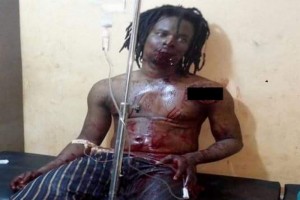 Ghana: Un féticheur trahi par ses forces et blessé