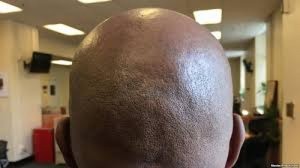 Mozambique: Les hommes chauves victimes de crimes rituels, déjà  deux morts