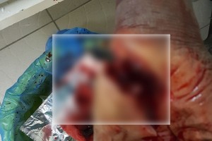 Côte d'Ivoire: Treichville, sous drogue un jeune libanais se coupe les veines et meurt