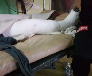 Côte d'Ivoire: Récentes attaques à  Abidjan, une victime par balles raconte son calvaire et dévoile l'identité du commando