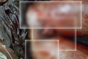 Côte d'Ivoire: Abobo, une femme violée et assassinée dans une rue