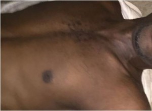 Côte d'Ivoire: Un homme s'écroule et meurt à  l'école Régionale de Treichville